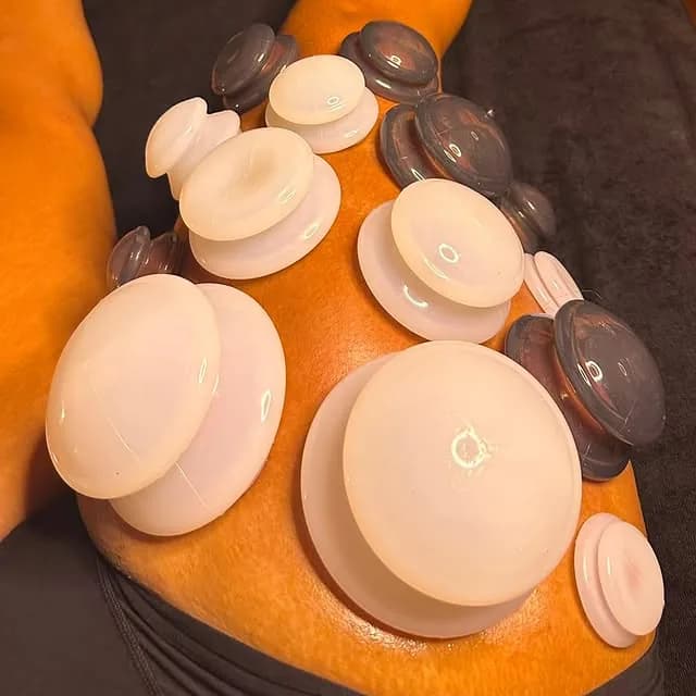Ventouses posées sur une jambe